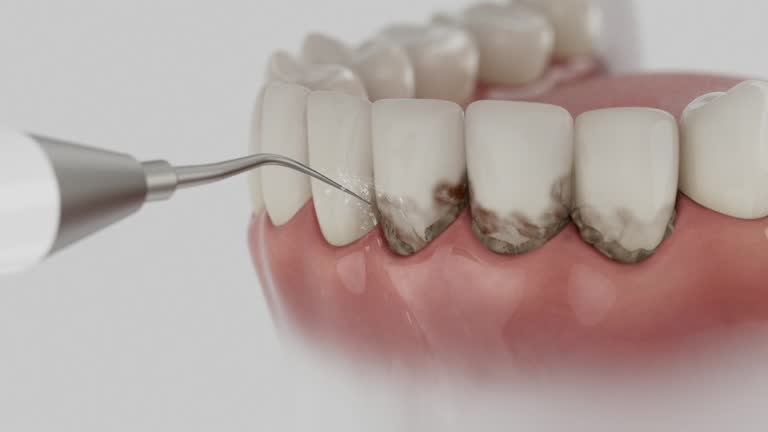Reliable Dental Implants contractor in Oregon City, OR by Smile Center Dentistry